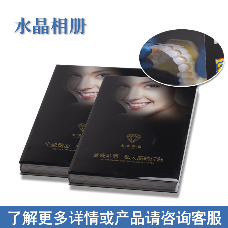 Belleza dental, carilla de porcelana de hielo, parche de cerámica sin metal, álbum de fotos de cristal, catálogo de visualización del cliente, material dental, carilla de porcelana de hielo image 1