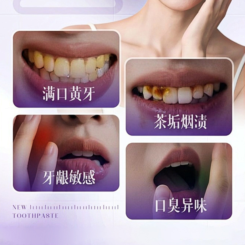 Auonam lisozima eliminación de manchas, pasta de dientes brillante, amarillo, brillante, suave, limpia, eliminación del olor oral, cuidado de los dientes image 3