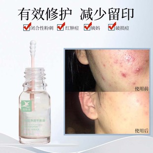 ��ޑ�������ӡˮ�����տsë�׾��AҺȥ�]�ڶ����۴�ԭҺ���yƷ