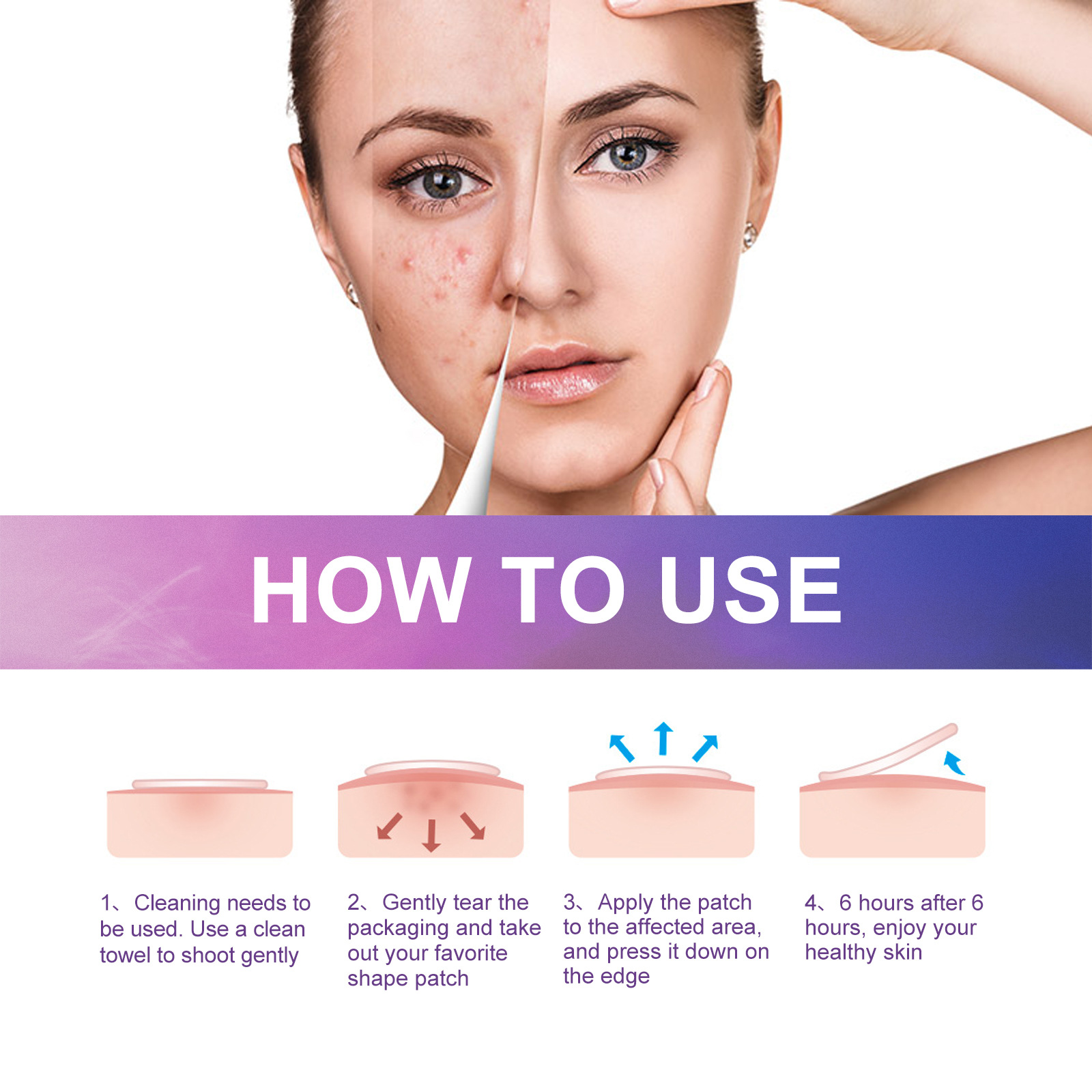 Patch hydrogel acné jaysuing pour atténuer les taches et boutons_voghion.com