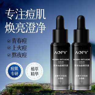 AOPY����AҺƤ����ˮ������۴̶������^�����ˮ���ᾫ�A