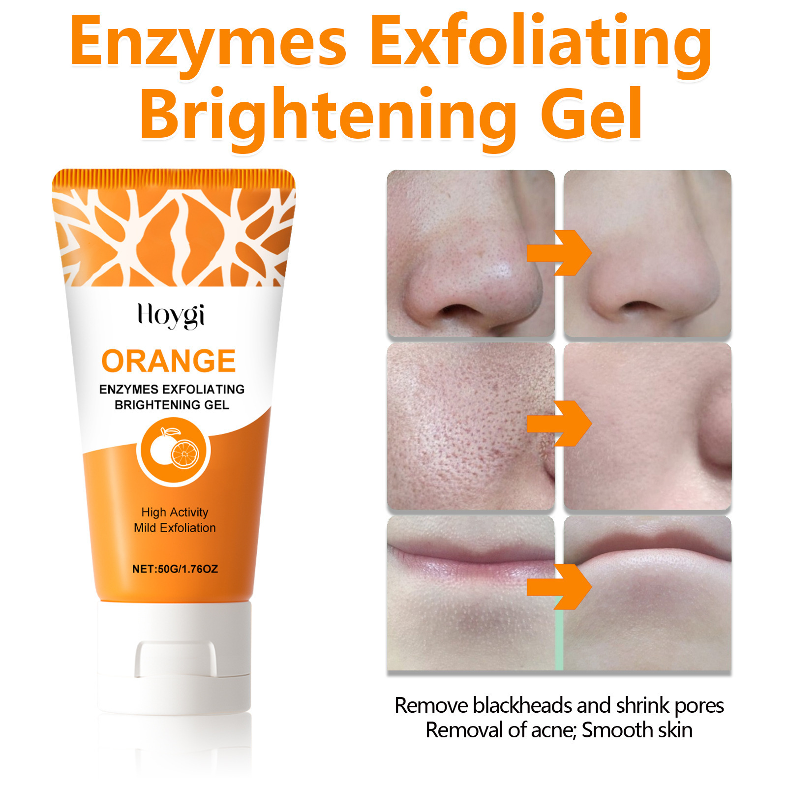 Hoygi exfoliante gel para los puntos negros esfoliante suave para los puntos negros contrae los poros para aclarar y suavizar la piel delicada.