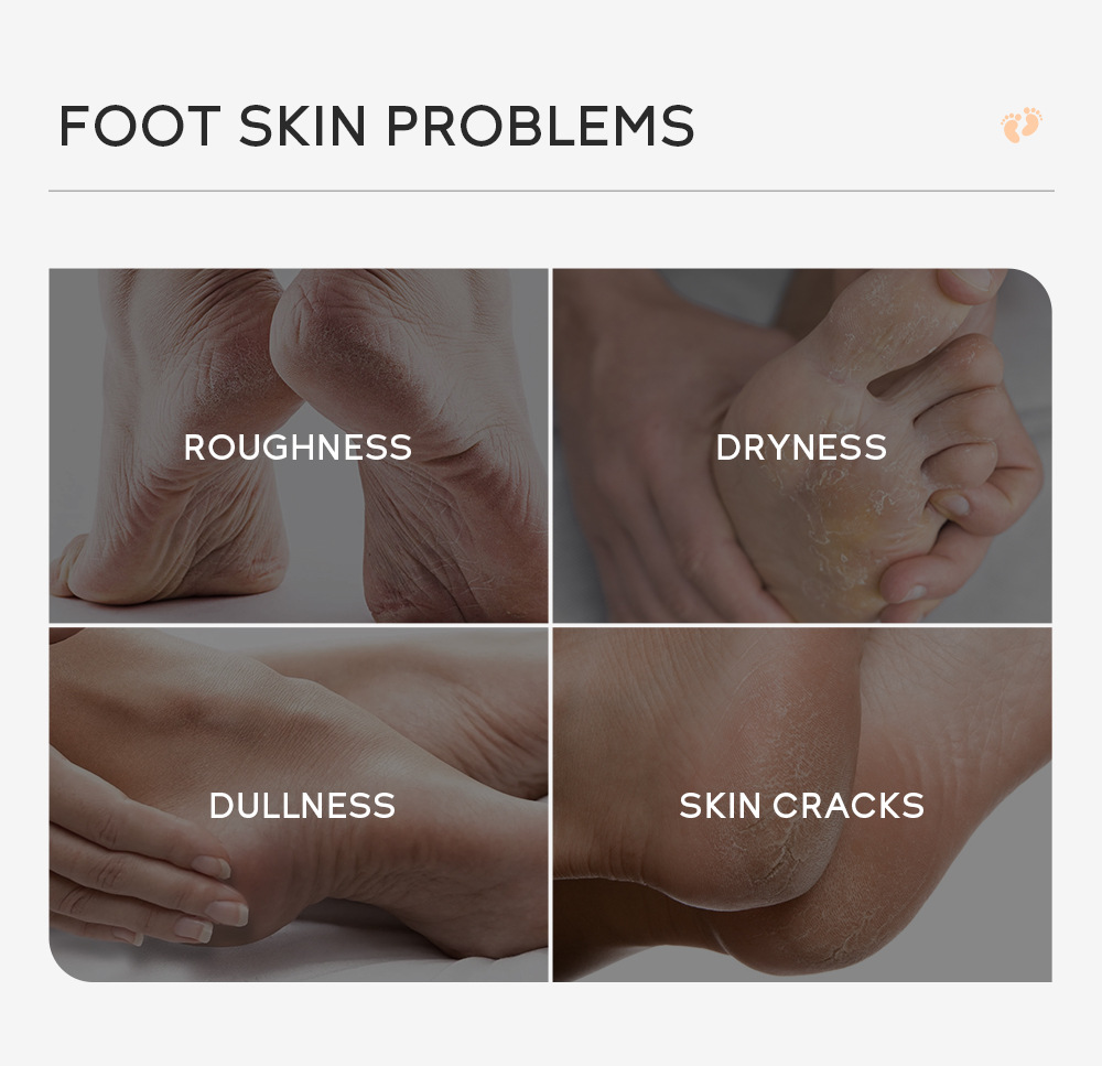 Cross-border QUIYUM milk and honey peel-off foot wax e foot care keratin manufacturer's wholesale in stock undefined