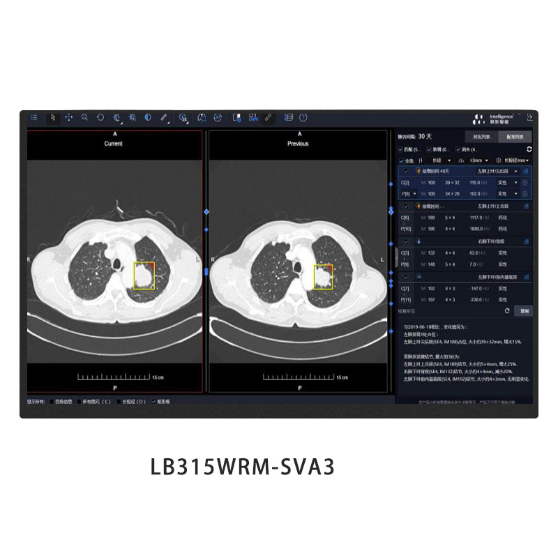 31.5-Inch 3840*2160 High-Definition 4K Lcd Screen Lb315Wrm-Sva3 Industrial Control Medical Imaging Display Screen