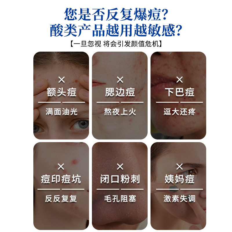 香港大药房痘痘净草本祛痘膏控油去痘印去粉刺温和净颜植物祛痘膏|undefined