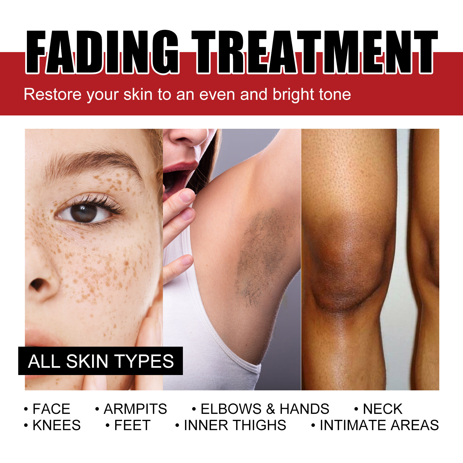 West&Month Spot Correction Cream reparerar ansiktsmörker, svarta fläckar, fräknar, fuktgivande, blekning och_voghion.com