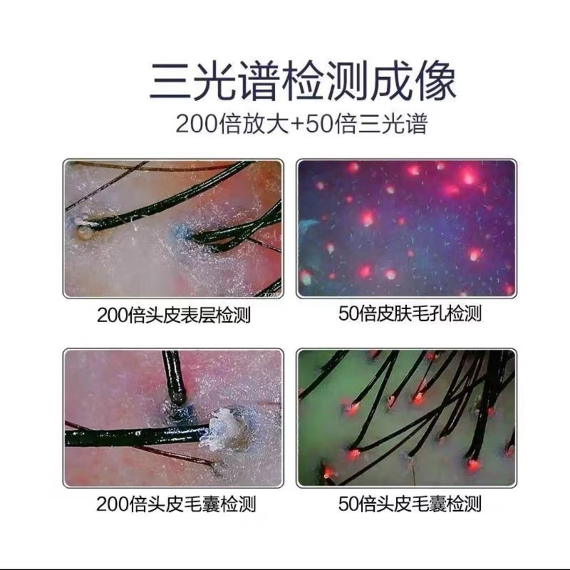 脱毛防止頭皮検出器デスクトップ毛包高清四スペクトル一体機頭療養髪館理髪店専用|undefined