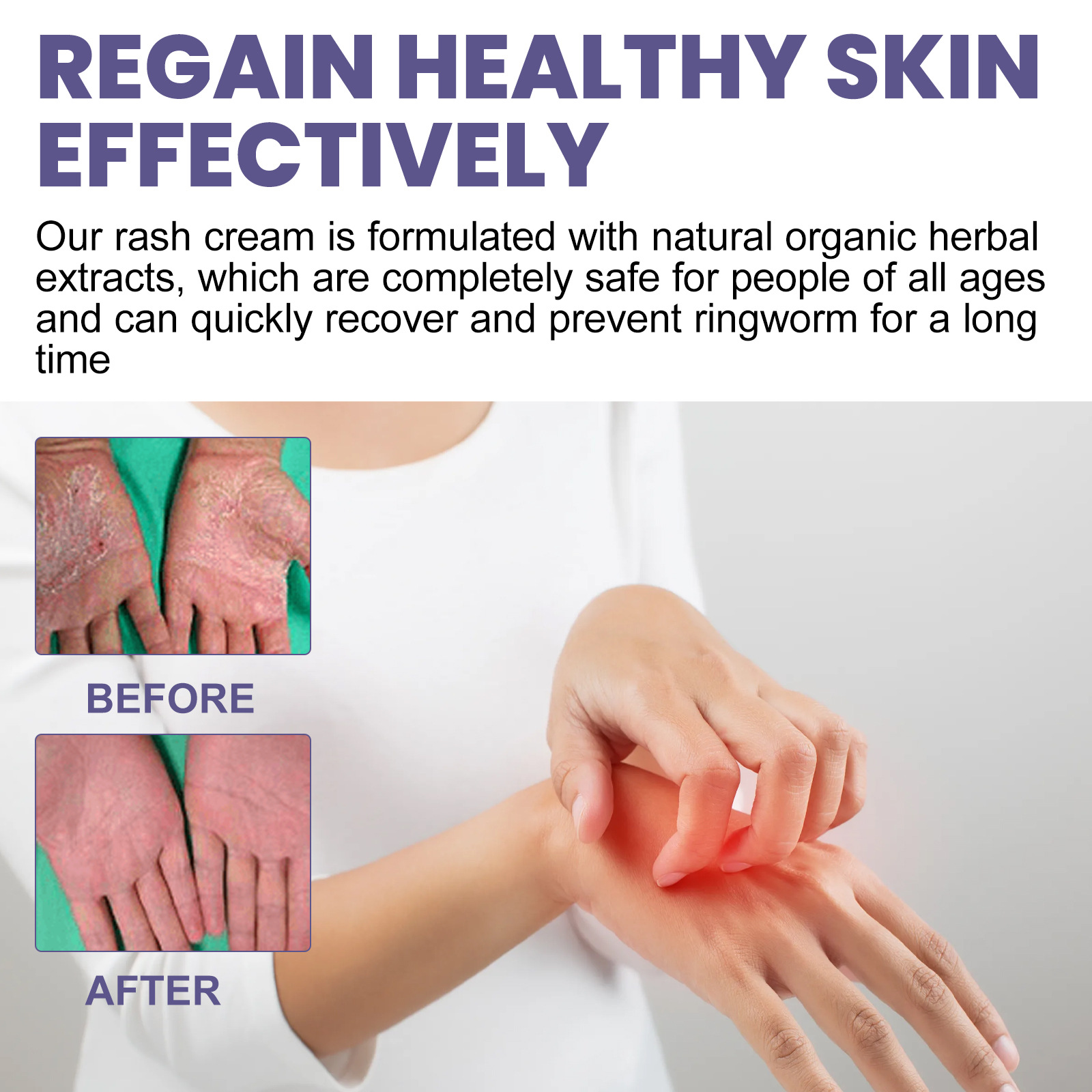 South Moon Skin Repair Cream herstelt de moshuidbarrière, verlicht roodheid en jeuk, hydraterende huidcrème_voghion.com