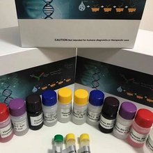 抗肝肾微粒体抗体ELISA检测试剂盒/抗核糖核蛋白抗体检测试剂盒