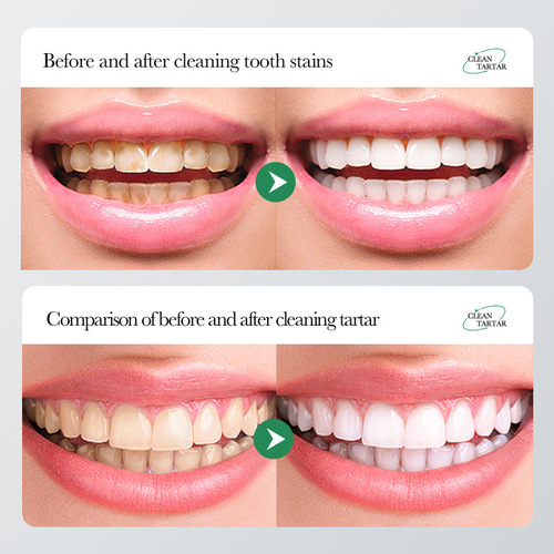 BIOAOUA baking soda nicotinamide whitening remove yellow care gum toothpaste fresh mouth toothpaste cross-border