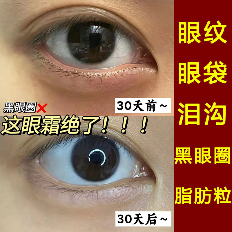 眼霜抗皱去眼袋细纹皱纹紧致提拉保湿滋润淡化黑眼圈眼霜工厂批发|undefined