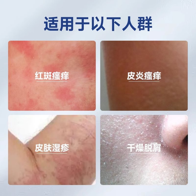 修正医療用皮膚ジェル皮膚炎湿疹敏感肌軟膏乾燥フケ発赤かゆみ工場|undefined