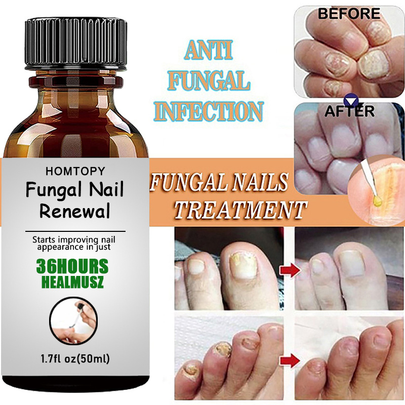 HOMTOPY Cross-border New Product Nail Fungus Liquid Repair Nourishing Liquid Shiny Nail Essence Nail Cleaning Repair Essence