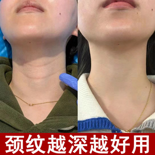 Neck Mask Neck Cream Neck Line Cream Removes Neck Lines Dry Neck Beauty Cream Lifts and Firms Cream Moisturizing Neck Mask Fades Neck Lines Mask