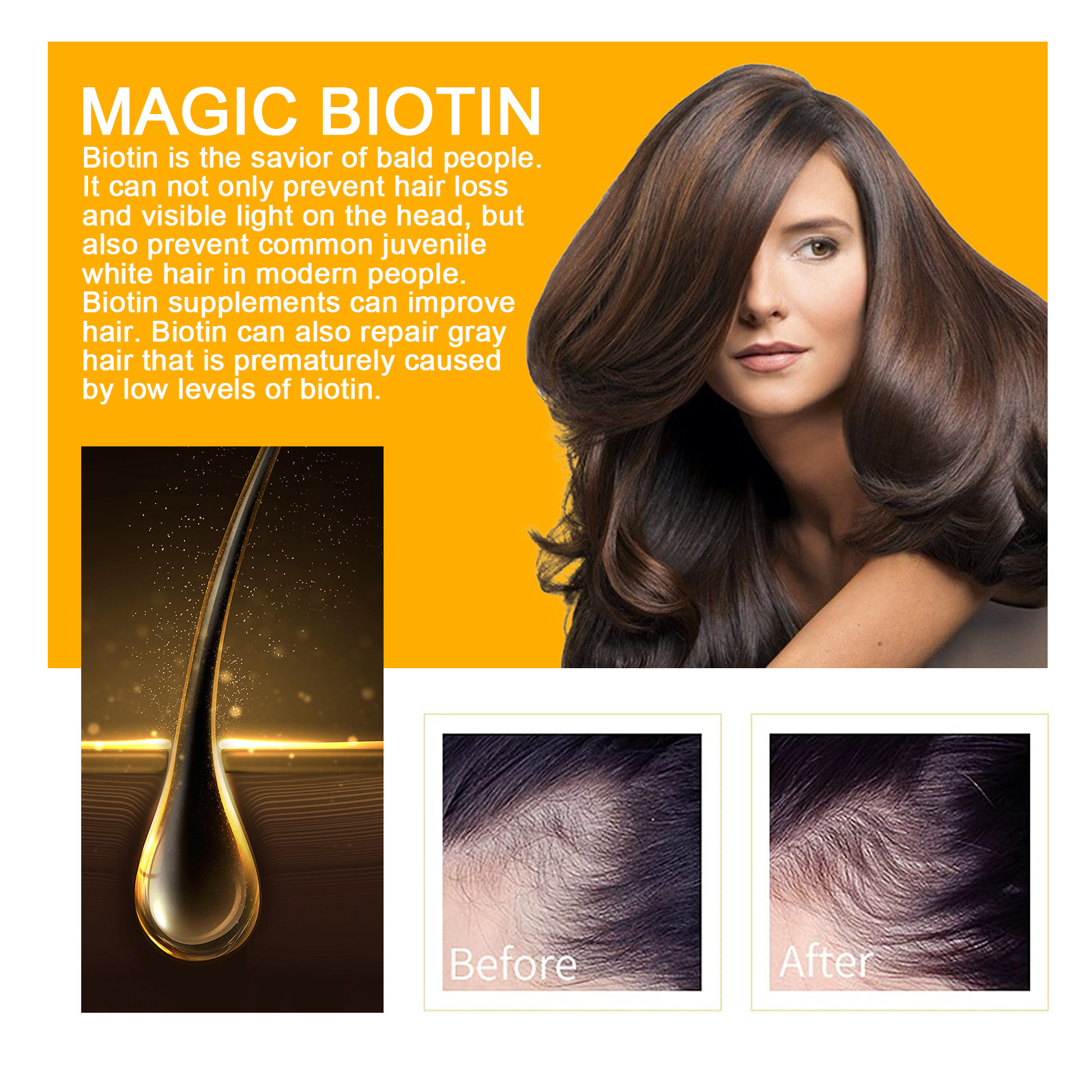 Spray capilar denso con biotina EELHOE, reparador y nutritivo para el cabello, cuidado del cabello, fortalecedor del cabello, spray antienvejecimiento para las raíces_voghion.com