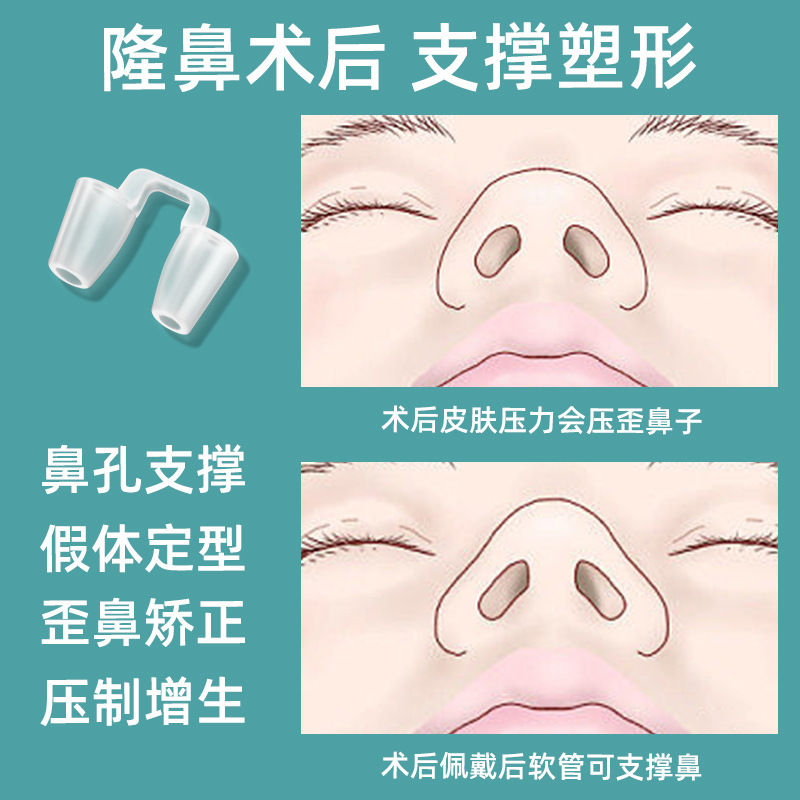 隆鼻器術後に矯正器の鼻孔を支えて変形防止固定器を広げます。|undefined