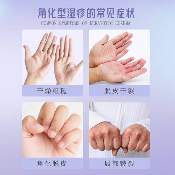 Weibohe Sodium Heparin Cream Improves Dark Circles, Eye Bags, Dry Peeling, Moisturizing and Moisturizing Eye Care Ointment