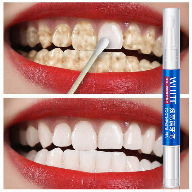 Whitening Yellow Teeth Quick-acting Bad Breath Artifact Pen Wipe Gel to Beautify Teeth, Remove Cleaning and Remove Tartar, Cold Light Teeth Whitening Pen