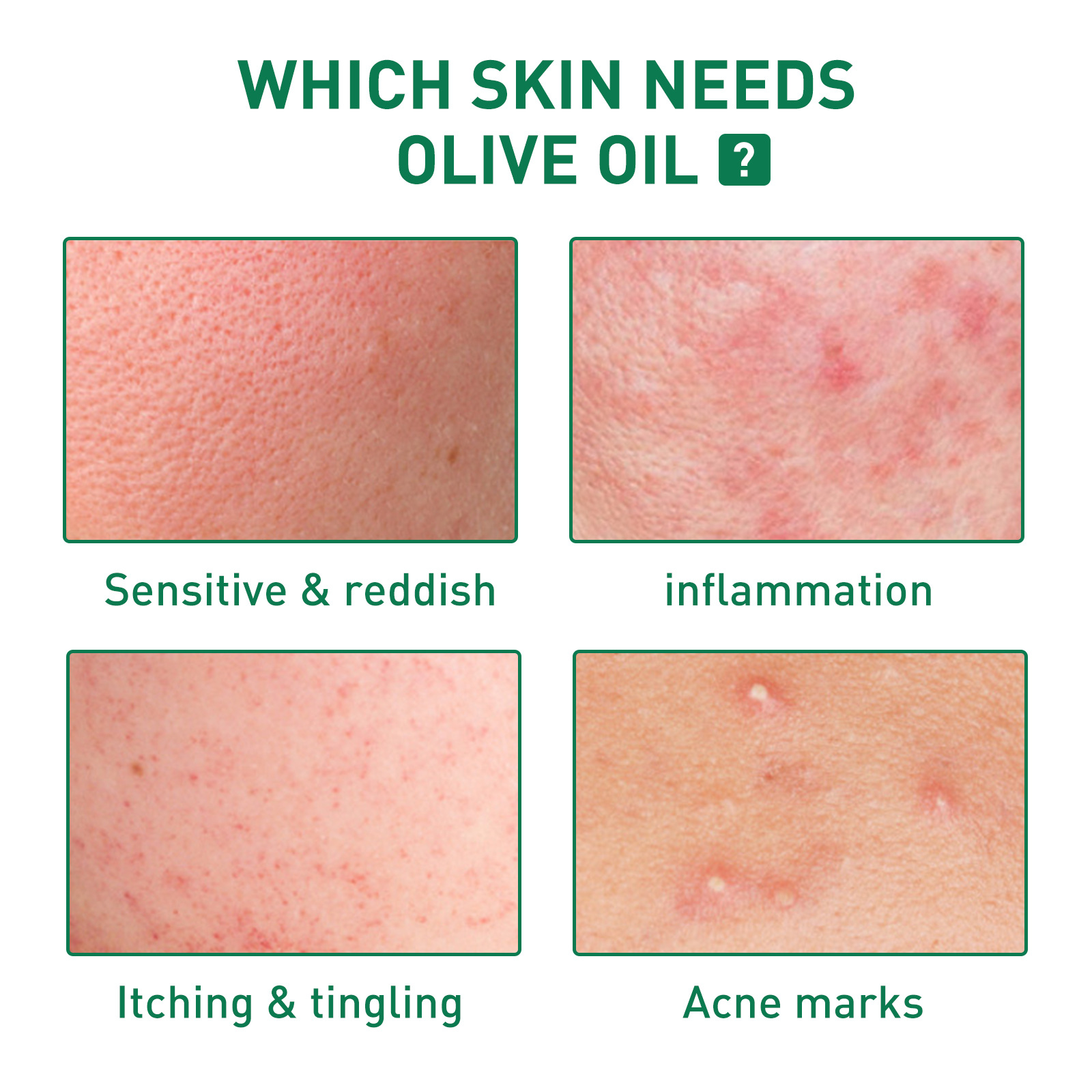 Jayswing Tea Tree Oil Lightens Marks, Moisturizes Repairs Facial Sensitivity, Reddening and Acne Removing essence_voghion.com