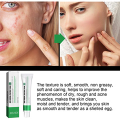EELHOE Acne and Spot Removal Cream - Brightens Skin, Fades Spots, Hydrates and Soothes