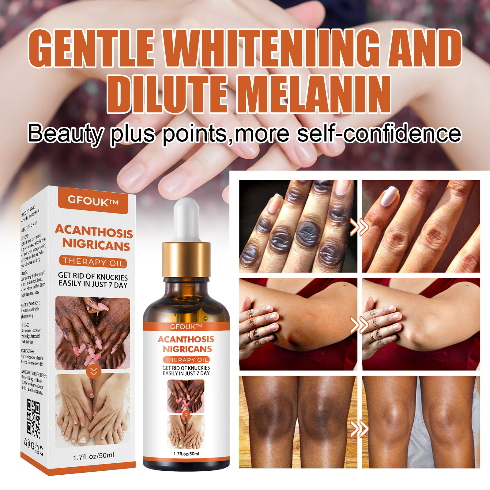 Gelenkverschönernde, feuchtigkeitsspendende und aufhellende, hautreparierende Essenz mit Melanin für Knie- und Sprunggelenke_voghion.com