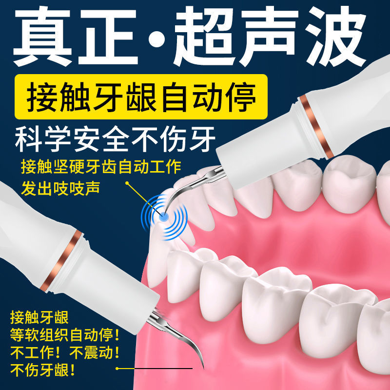 冲牙器胖猫超声波洁牙机大功率洗牙去除器牙齿清洁器去牙渍电动|ms