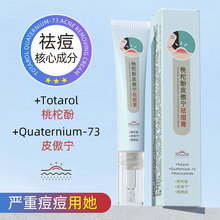 ���޷�Ƥ�������ȥ���ޏ��澏���A������ӡ�����ഺ����Ů�W��