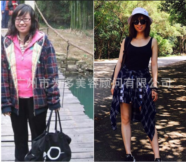 减肥前后对比图51