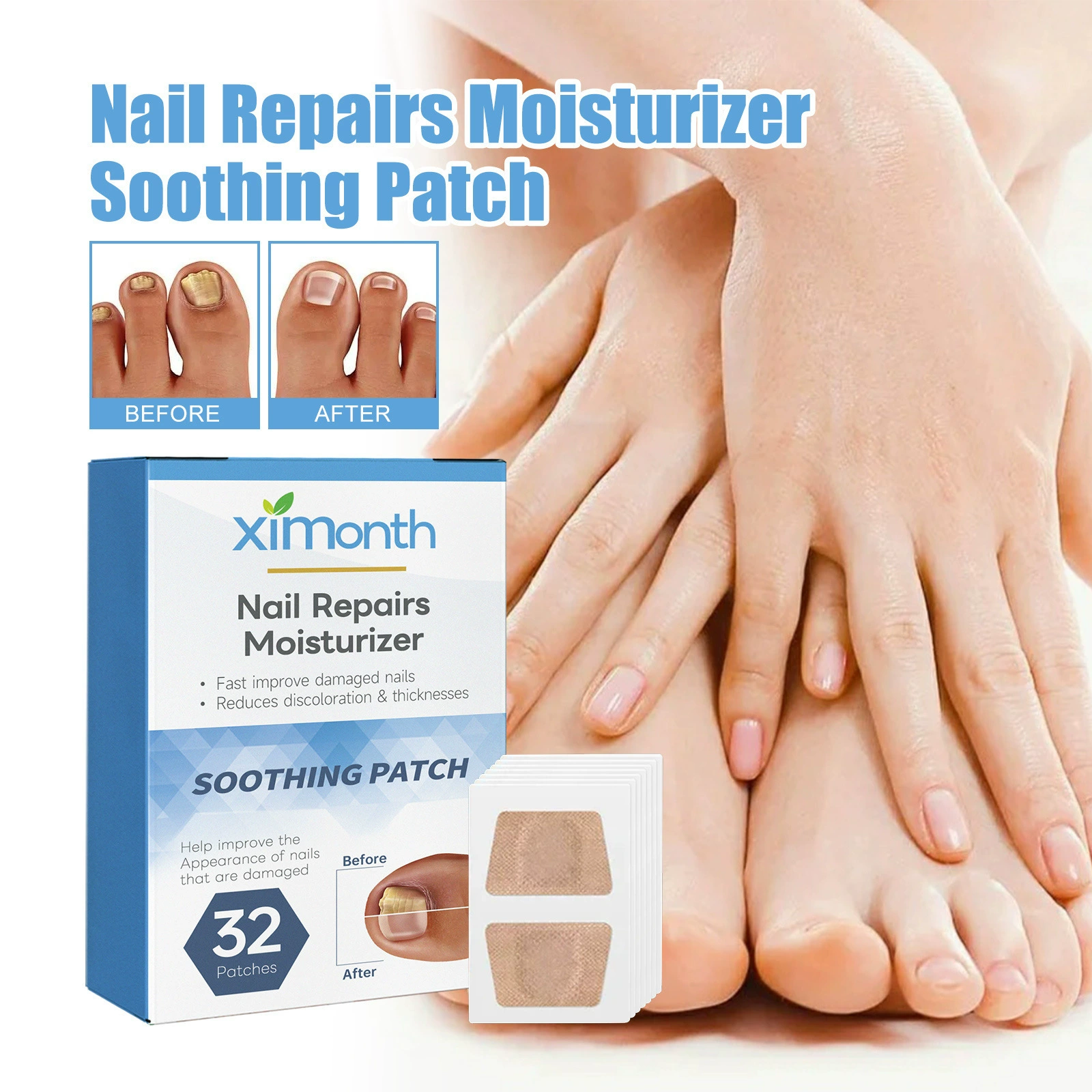 Пластырь для ухода за ногтями Ximonth, лечение онихомикоза, мягкий пластырь для ухода за вросшими ногтями, утолщение ногтей