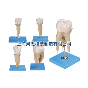 Tooth Magnification Model
