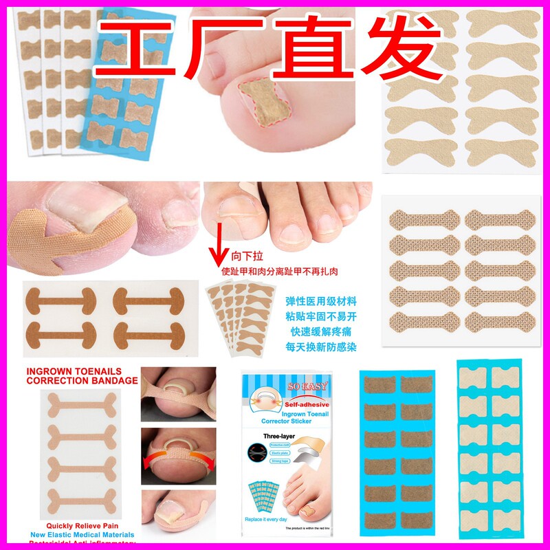 Specially Designed for Cross-Border Toe Patches, Glue-Free Self-Adhesive Nail Groove Ingrown Toenail Corrector, Toenail Patch Correction