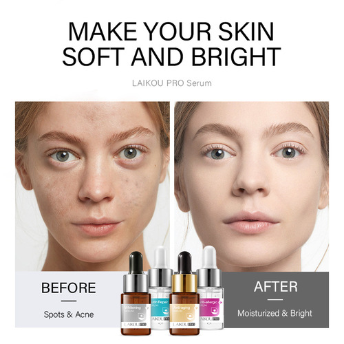 LAIKOU LEIKOU PRO 4-color Essence Liquid 12ml Moisturizing and Hydrating Skin Care Products Cross-border Sources of English Packaging 