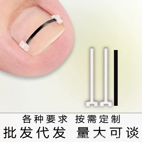 Nickel-Titanium Memory Metal Nail Correction Tool for Ingrown Nails, Nail Correction Clip, Nail Correction Pad, Toenail Trimming Tool