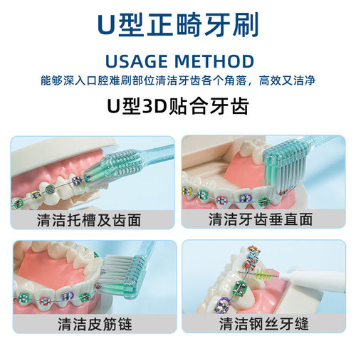 Xiaolu Mama Orthodontic Toothbrush L+U Type Braces Brush Orthodontic Braces Brush Orthodontic Soft Bristle Toothbrush Wholesale