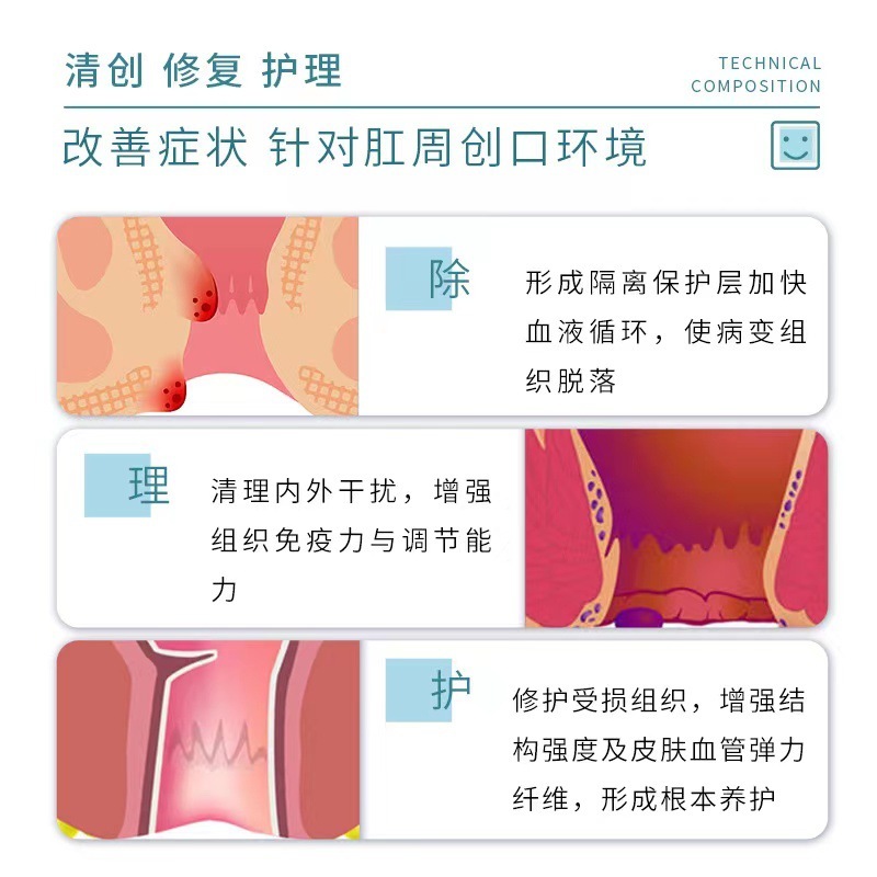王耀仙痔核栓冷湿布ジェル、かゆみ止め痔核軟膏、ハーブエキス配合、男女兼用軟膏、安全な外用、無刺激|undefined