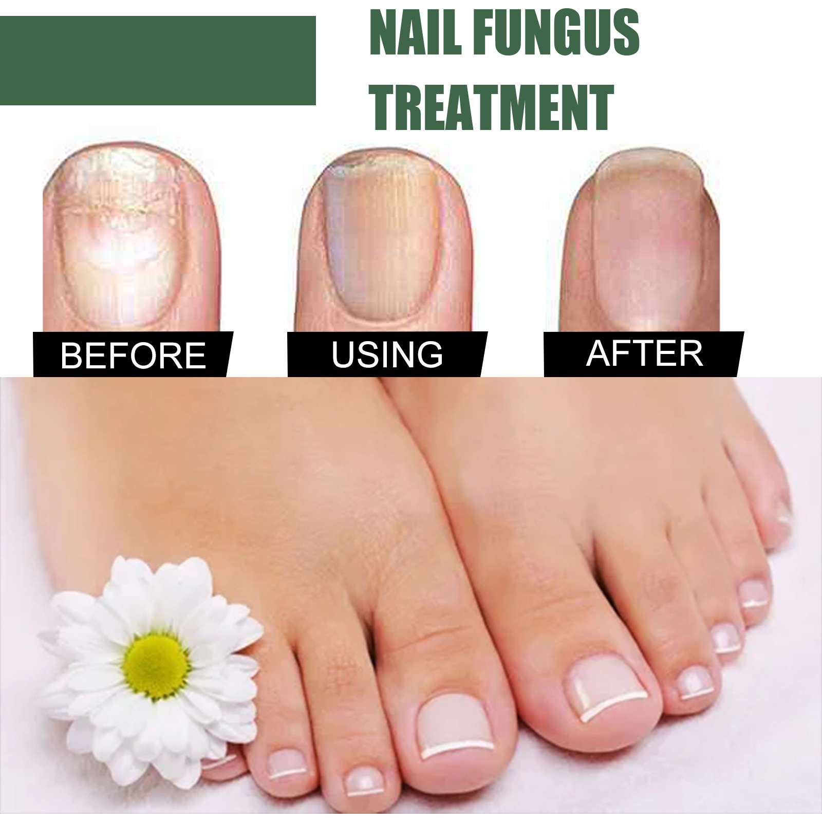 EELHOE Nail Care, una solución de hidratación suave y limpia para uñas gruesas y suaves en la superficie de las uñas. image 3