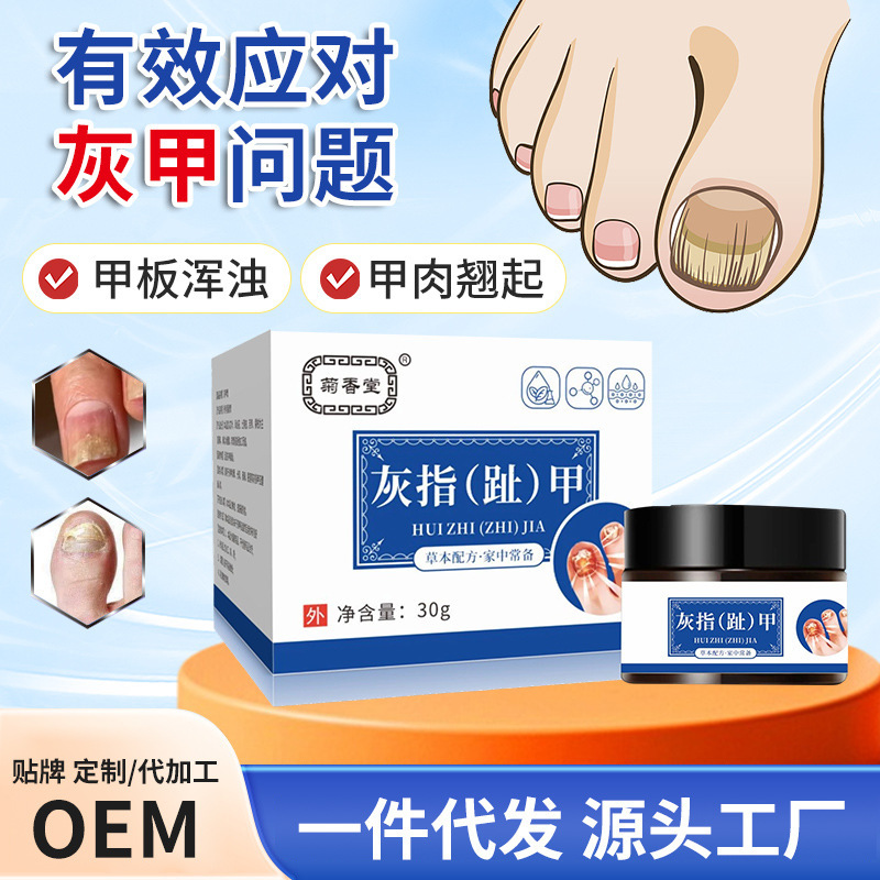 爪真菌軟膏、親指ケア軟膏、爪の明るさ、爪の除去、厚い爪、爪溝、爪真菌症軟膏|undefined