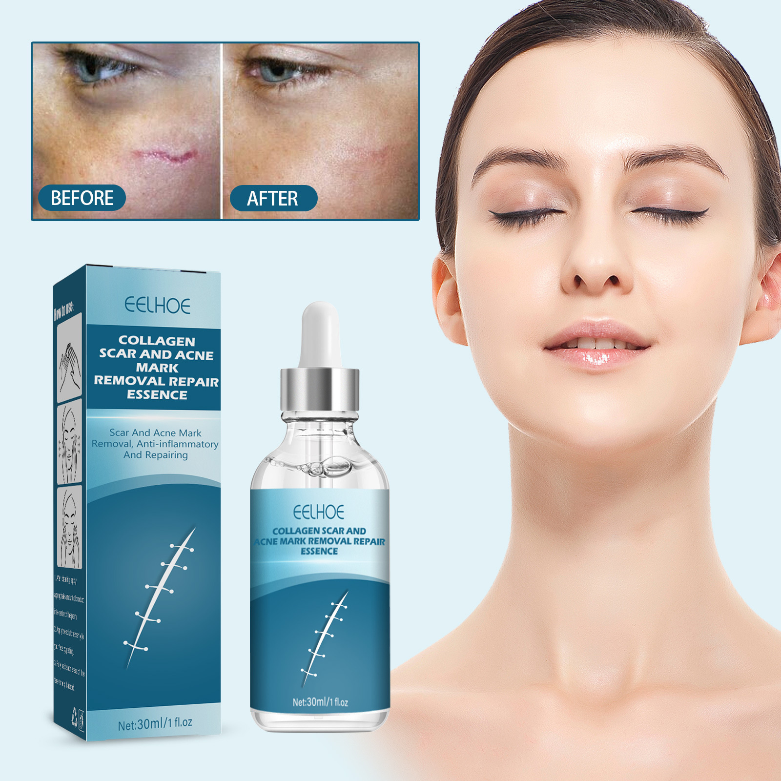 EELHOE Essence de réparation de cicatrices, estompe les cicatrices chirurgicales, essence de réparation de cicatrice de césarienne, lisse et hydrate la peau, (paquet de 3)_voghion.com
