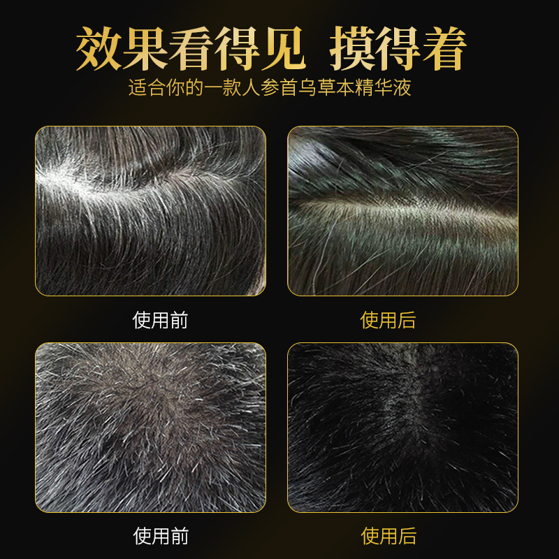 仁和匠心愛膚宜人參首烏草本精華烏髮液白頭轉黑髮男女通用批發