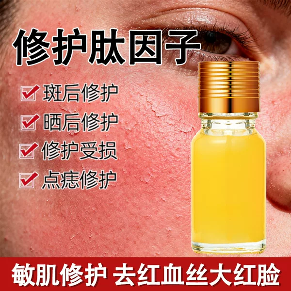 Beauty Salon-Specific Repair Peptide Repair Gel to Remove Red Marks, Epidermal Repair Factor, Spot and Mole Care Cream