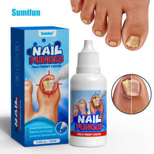 sumifun���uͨ�羳ָ��Һ���ˮܛ��Ó���㲿�o������ҺK60001