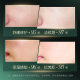 SUSUWISH Ceramide Moisturizing Soothing Essence Moisturizing and Improving Dry Skin Facial Essence