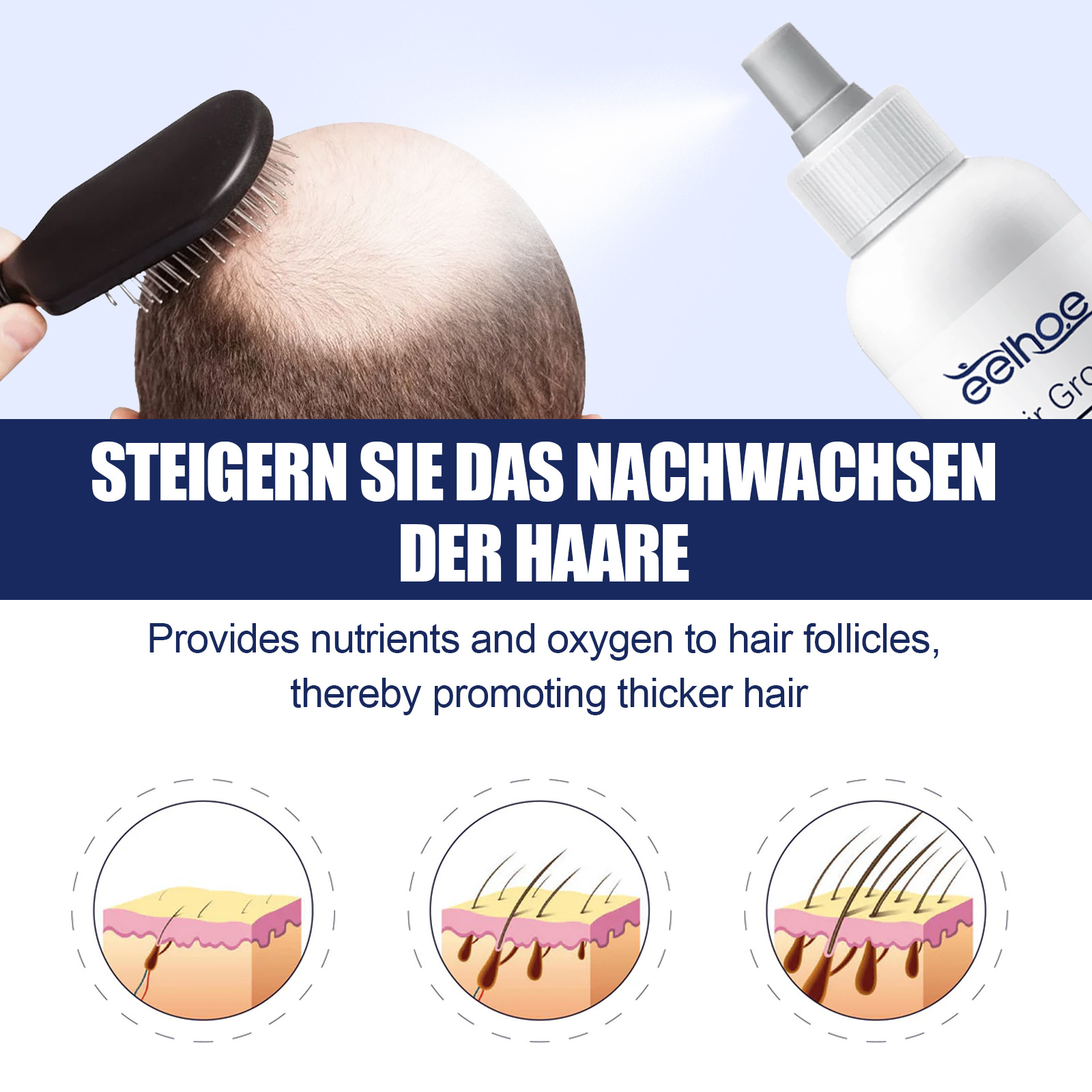 EELHOE essentiële olie voor kruidenverzorging voor verzorging, sterk, stevig haar, preventie van verlies, herstel van dicht haar en_voghion.com