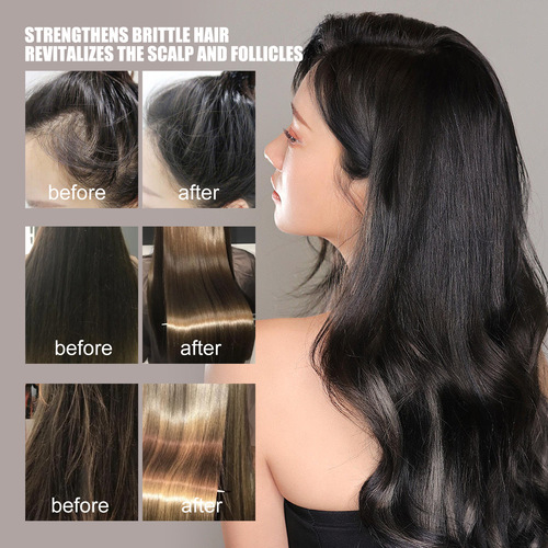 Jaysuing rosemary shampoo prevents hair loss, oil control, fluffy, refreshing and smooth, smoothes dry and frizzy hair