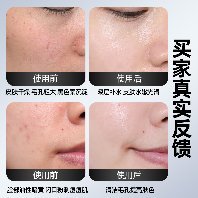 Aparatos de belleza facial de doble pulverización fría y caliente el agua del aparato de belleza abre los poros del aparato de vapor facial el aparato de pulverización térmica doméstico se utiliza en el Salón de belleza.
