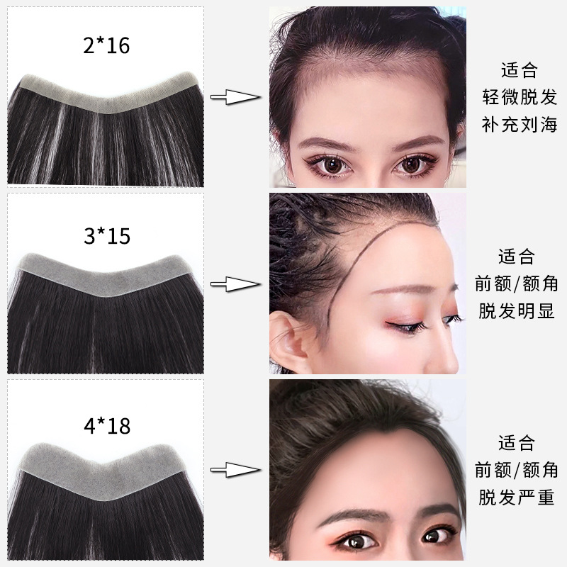 Parche de pelo biológico del cuero cabelludo de la línea de la frente de las mujeres fábrica al por mayor invisible completo tejido a mano Peluca de pelo real