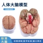 分布动脉大脑结构模型
