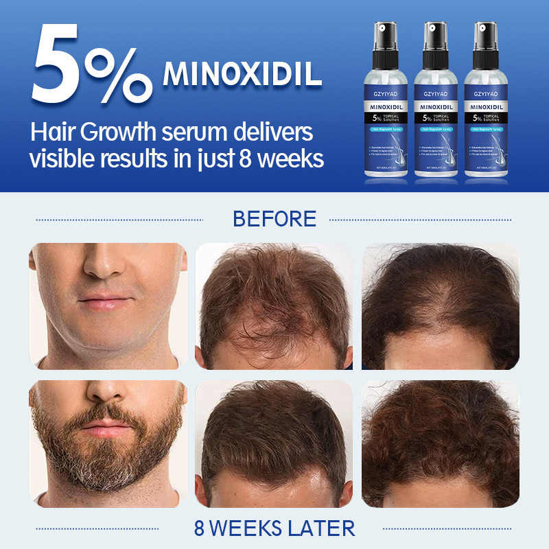 跨境5%米诺地亇儿酊溶液激活毛囊 头发再生密发液Hair Growth oil|undefined
