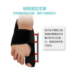亞馬遜拇外翻腳趾保護套拇指外翻矯正大腳骨分離矯正帶