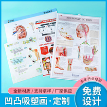 眼科医院视力表海报人体结构图内脏装饰凹凸立体画宣传挂图定制